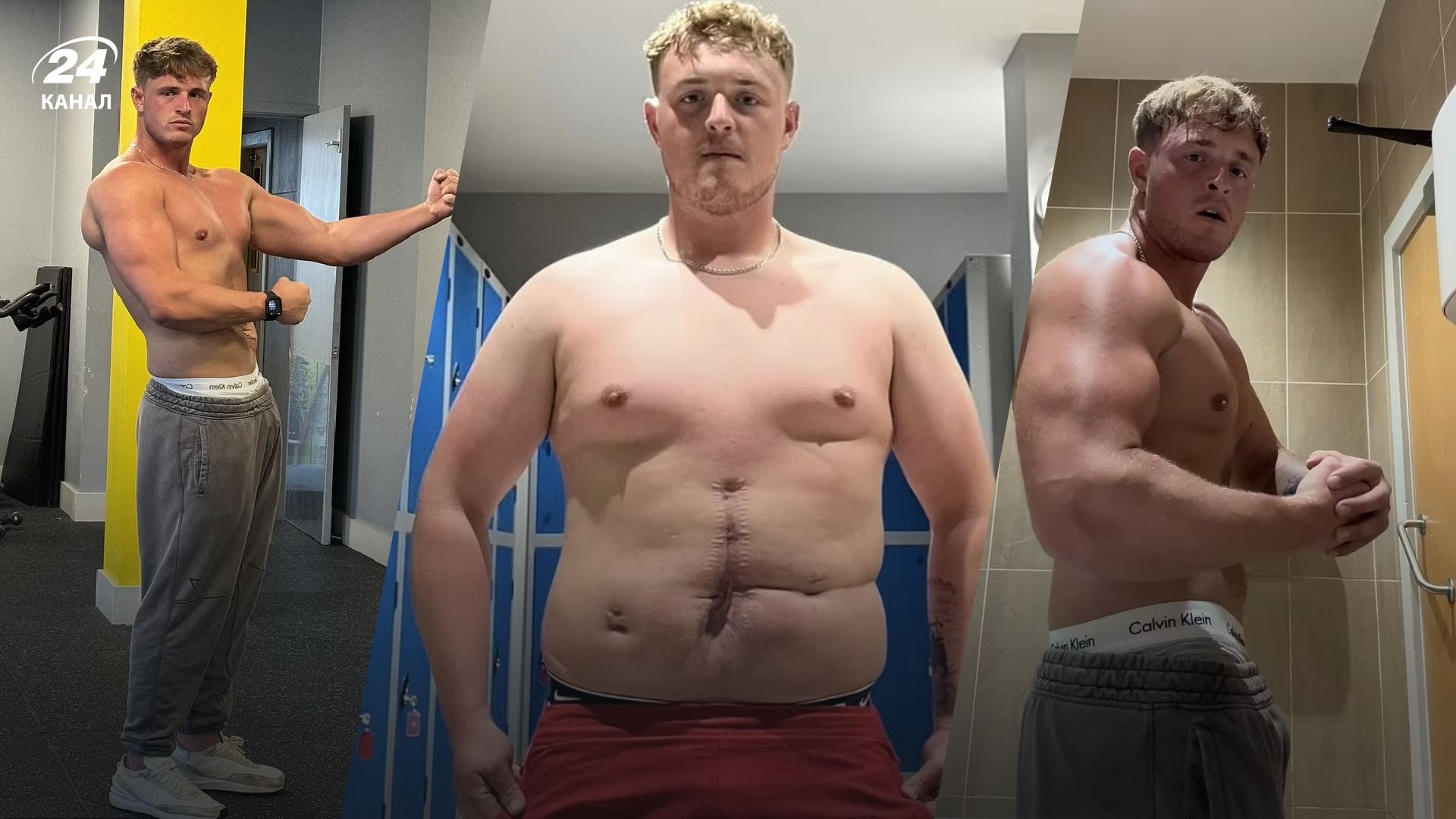 Надихаюча історія трансформації Коннора Майлза після пережитої жахливої ДТП - Gentleman Надихаюча історія трансформації Коннора Майлза після пережитої жахливої ДТП - Gentleman