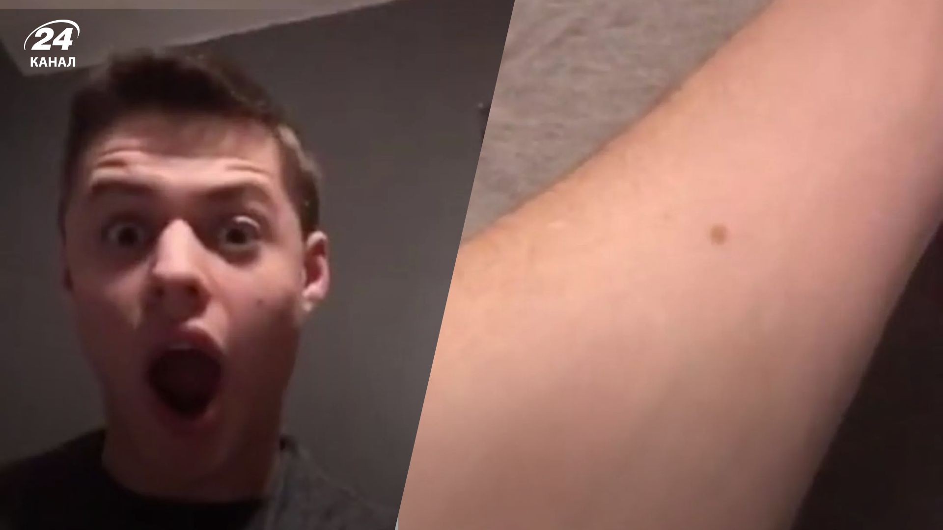 Все ли мужчины имеют родинку в одном месте - вирусное видео взбудоражило тикток - Gentleman Все ли мужчины имеют родинку в одном месте - вирусное видео взбудоражило тикток - Gentleman